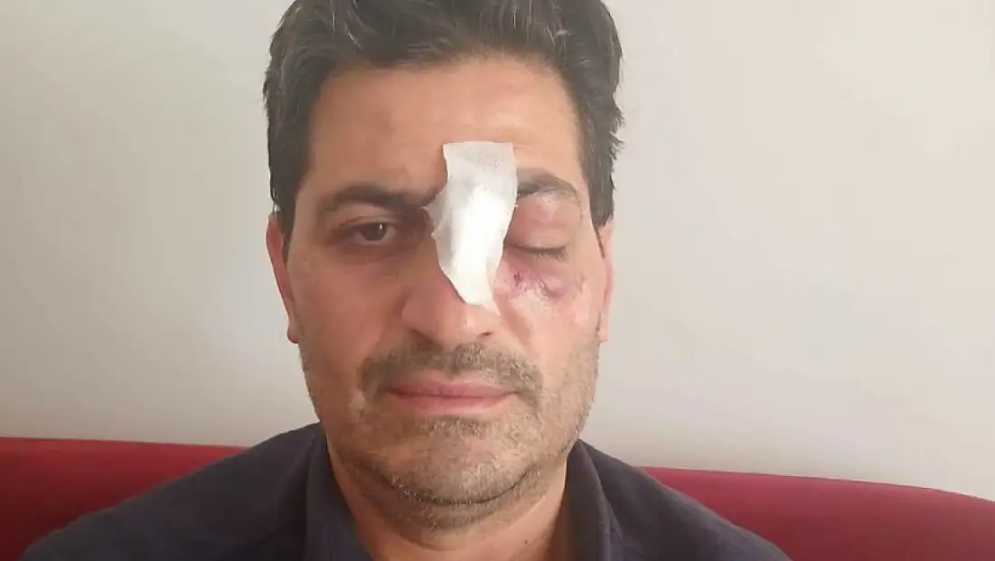 Cami avlusundaki uyarı kavgaya dönüştü: Müezzinin burnu kırıldı
