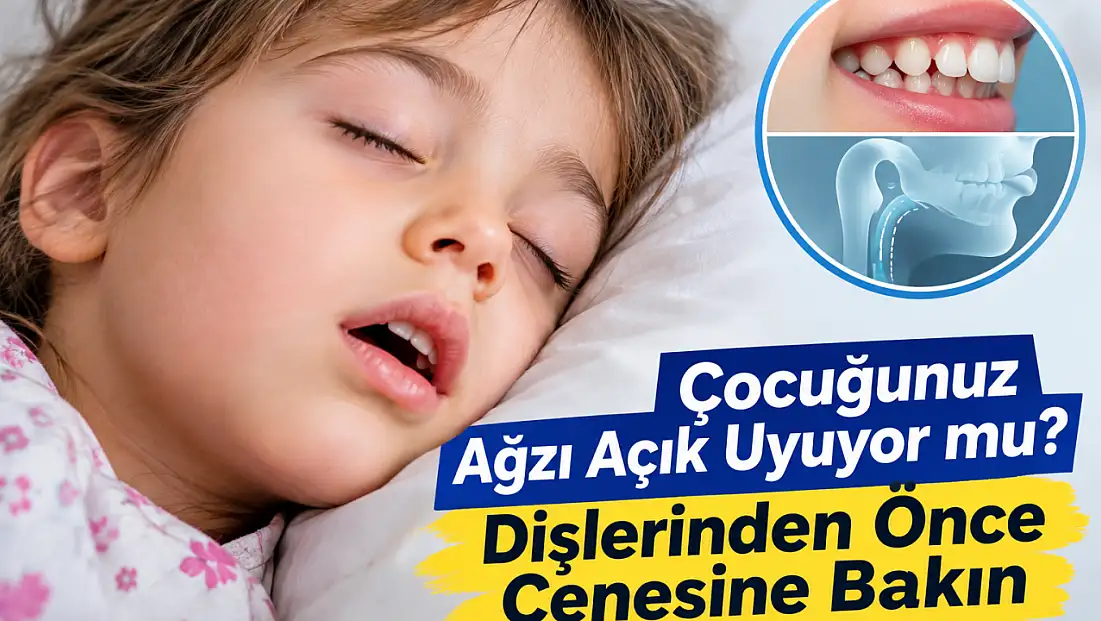 Çocuğunuz ağzı açık mı uyuyor? Dişlerinden önce çenesine bakın