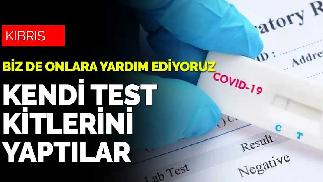 Türkiye'nin salgın döneminde yardım ettiği Kıbrıs'ta korona test kiti üretildi