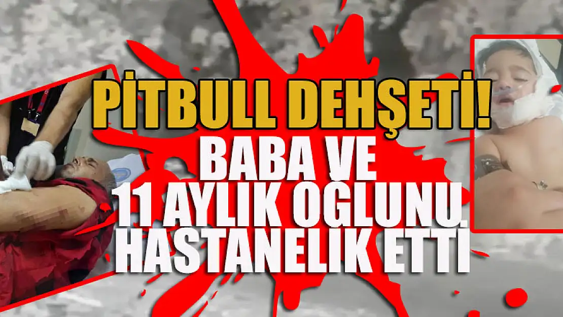 Pitbull dehşeti! Baba ve 11 aylık oğlunu hastanelik etti