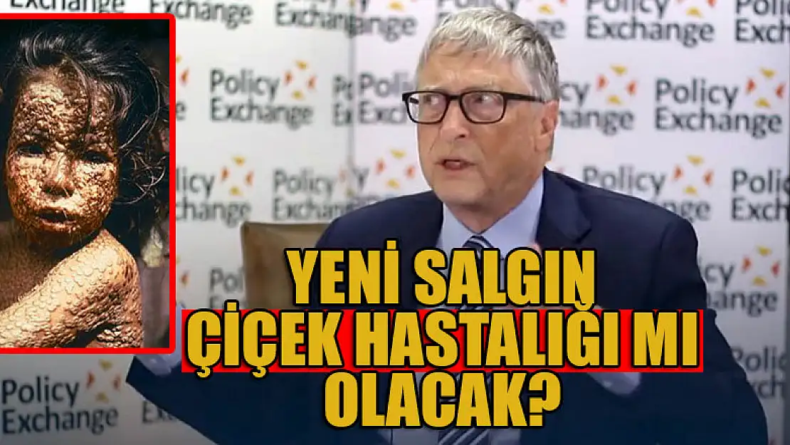 Yeni salgın Çiçek hastalığı mı olacak?