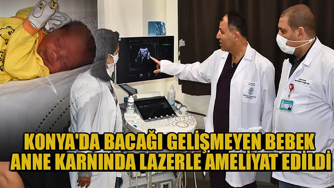 Konya'da  bacağı gelişmeyen bebek anne karnında lazerle ameliyat edildi