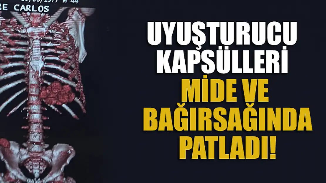 Uyuşturucu kapsülleri mide ve bağırsağında patladı