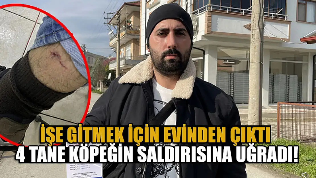 İşe gitmek için evinden çıktı, 4 tane köpeğin saldırısına uğradı