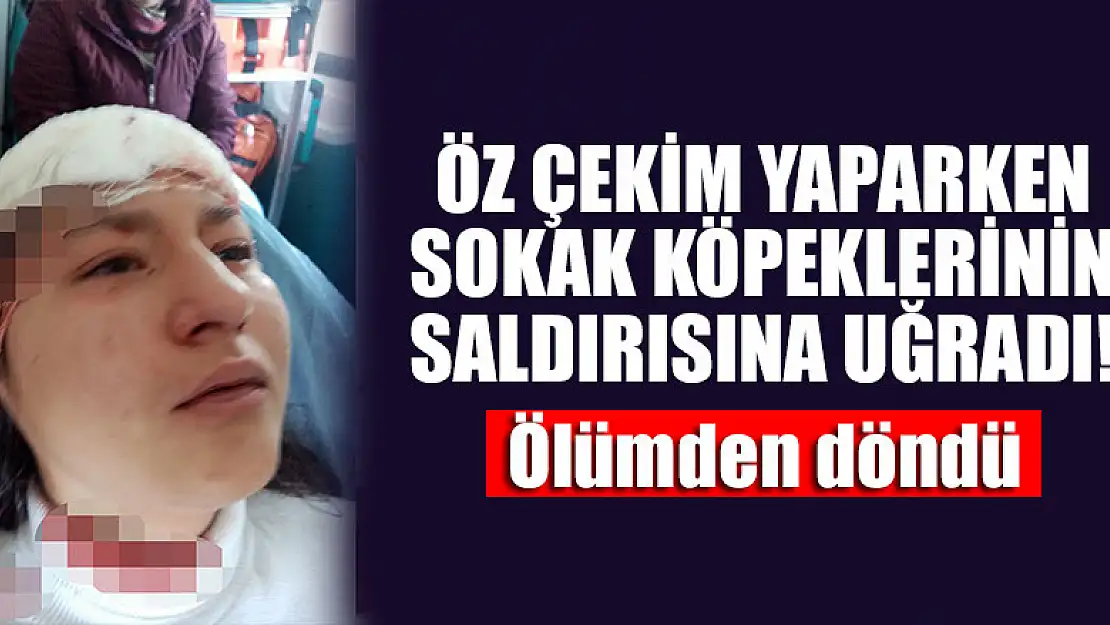 Öz çekim yaparken sokak köpeklerinin saldırısına uğrayan çocuk ölümden döndü