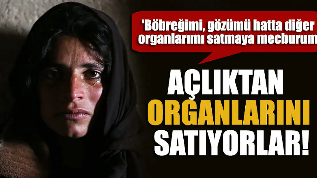 Açlıktan organlarını satıyorlar!