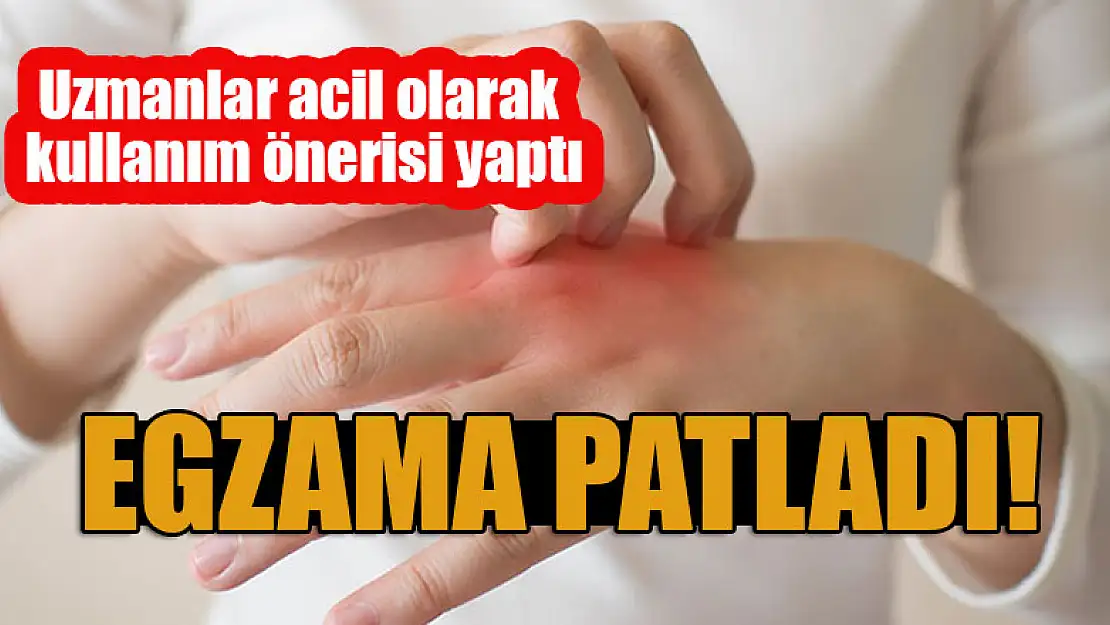 Egzama patladı! Uzmanlar acil olarak kullanım önerisi yaptı