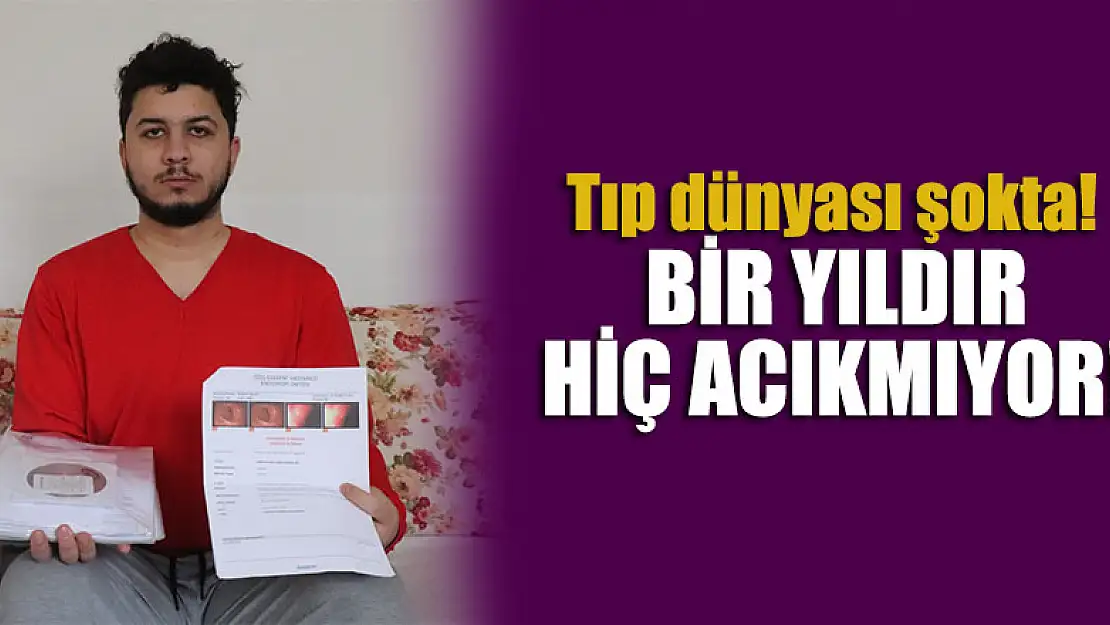 Tıp dünyası şokta! Bir yıldır hiç acıkmıyor