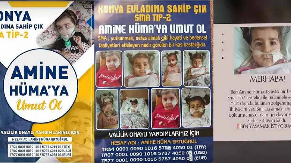 SMA hastası Amine Hüma bebek destek bekliyor