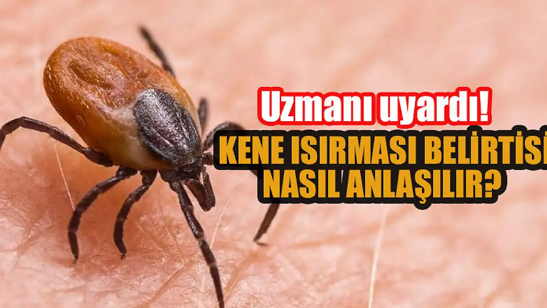 Kene ısırması belirtisi nasıl anlaşılır? Uzmanı uyardı!