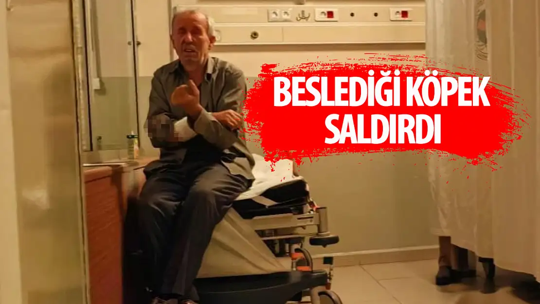 Beslediği köpeği tarafından saldırı uğradı: Kolu parçalandı!