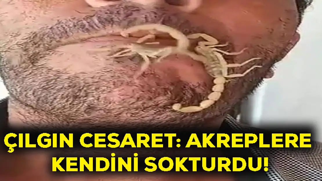 Çılgın cesaret: Akreplere kendini sokturdu!