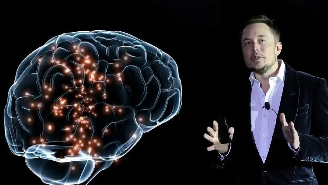 Elon Musk 2026'ya kadar 1.000 kişiye Neuralink Çipi taktırmayı hedefliyor