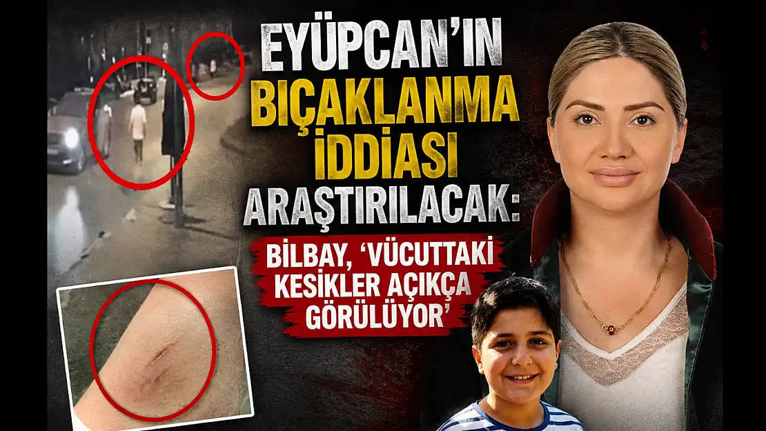 Eyüpcan'ın bıçaklanma iddiası araştırılacak: Bilbay, 'Vücuttaki kesikler açıkça görülüyor'