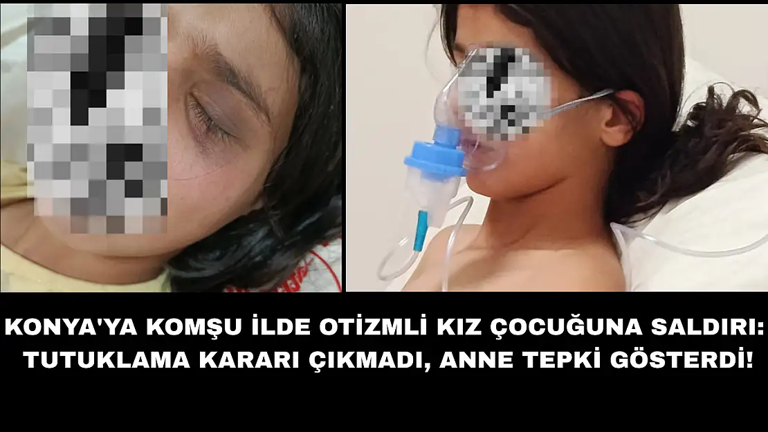 Konya'ya komşu ilde otizmli kız çocuğuna saldırı: Tutuklama kararı çıkmadı, anne tepki gösterdi!