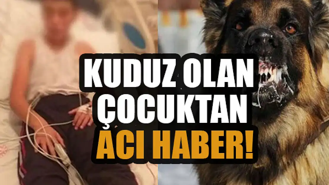 Kuduz olan çocuktan acı haber!