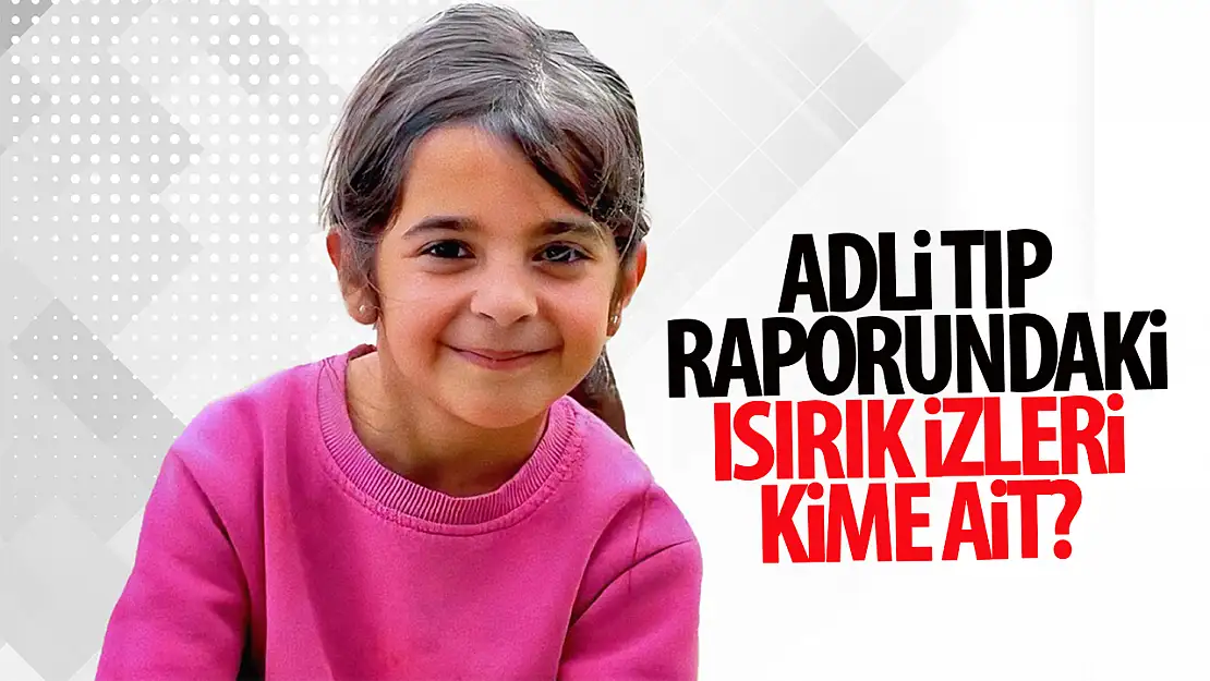 Narin'in kolundaki ısırıklar için Adli Tıp raporu çıktı: Isırıklar kime ait!