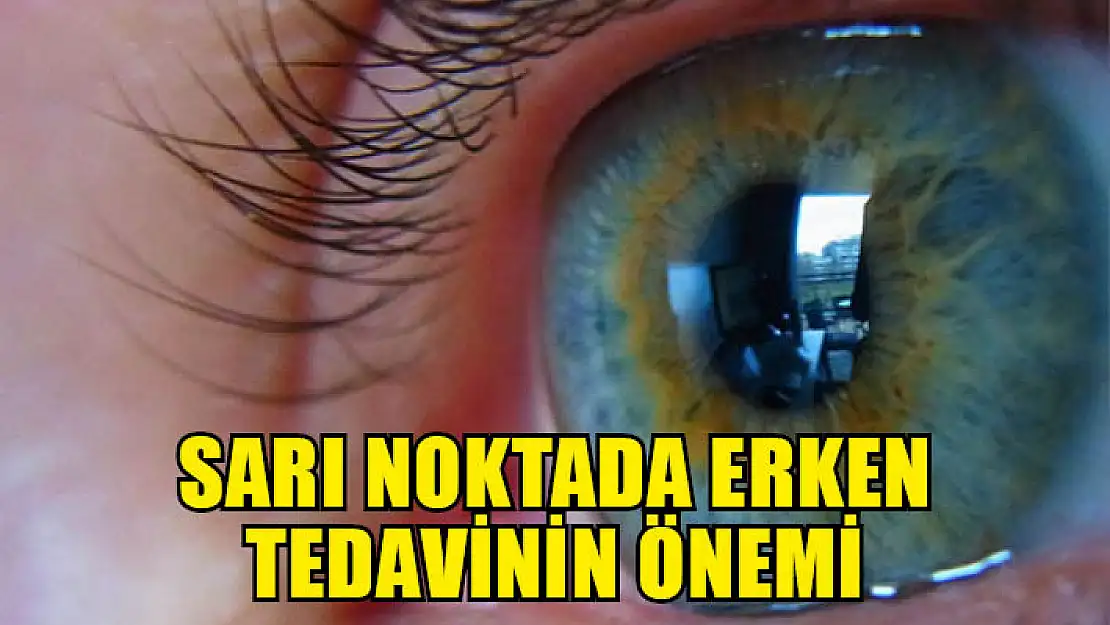 Sarı noktada erken tedavinin önemi