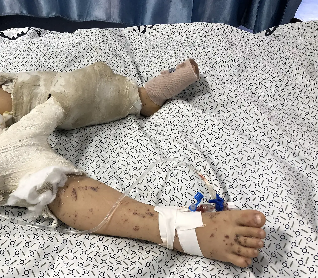 İsrail Saldırısında Ailesini Kaybeden Filistinli Çocuk, Hayatta Kalmaya Çalışıyor