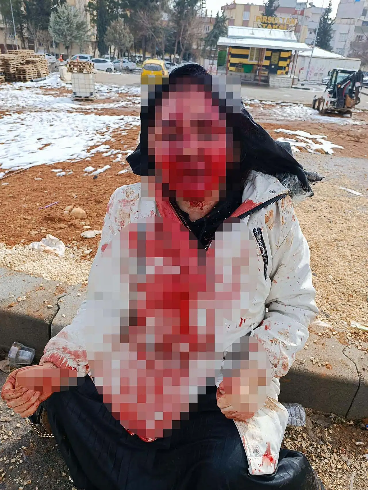 Düzeldim dedi, dehşeti yaşattı: Kaldırım taşıyla yüzü dağılan Nazlı yardım istedi