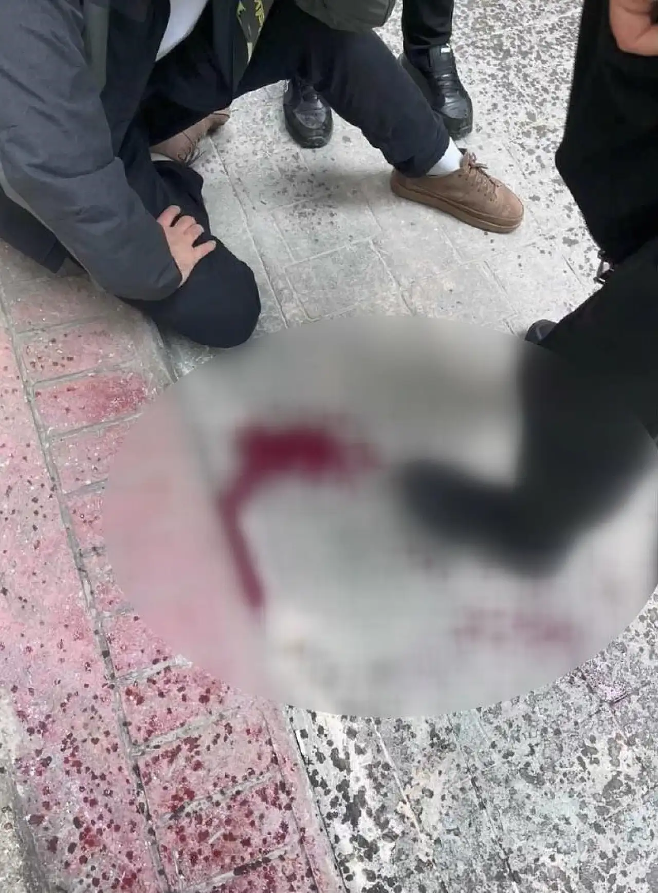 Kaldırımda yürürken dehşeti yaşadı: Başına 7 dikiş atıldı