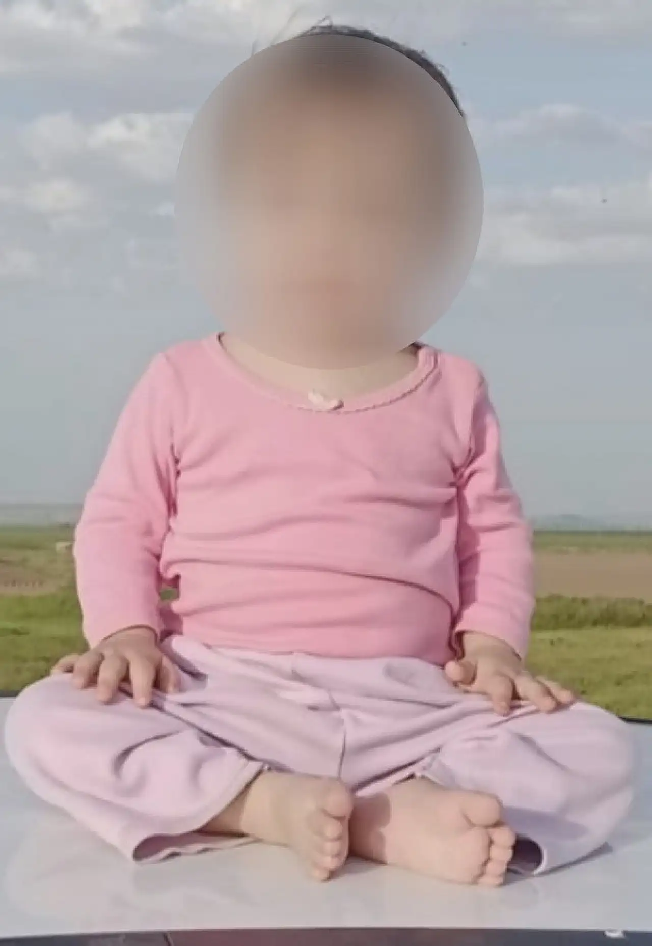 Down sendromlu bebek davası! Doktora 81 milyon liralık tazminat