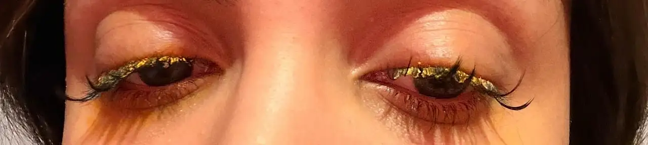 Kirpik yaptırmak istedi, dünyası karardı