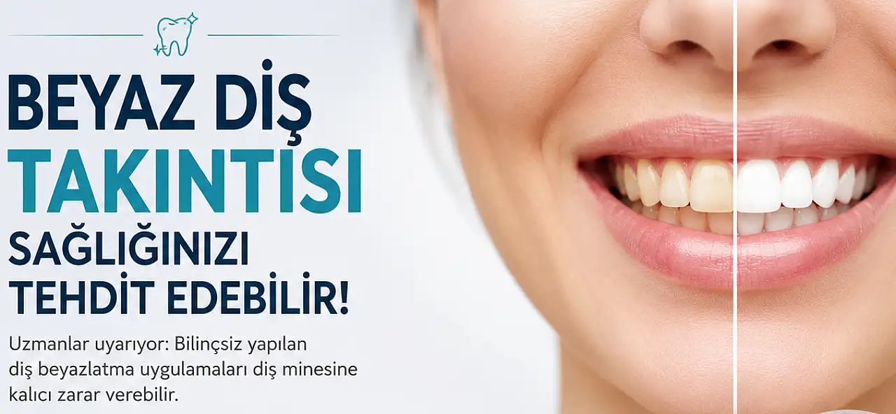 Diş Hekimi Kurşun uyardı: Beyaz diş takıntısı sağlığınızı tehdit edebilir