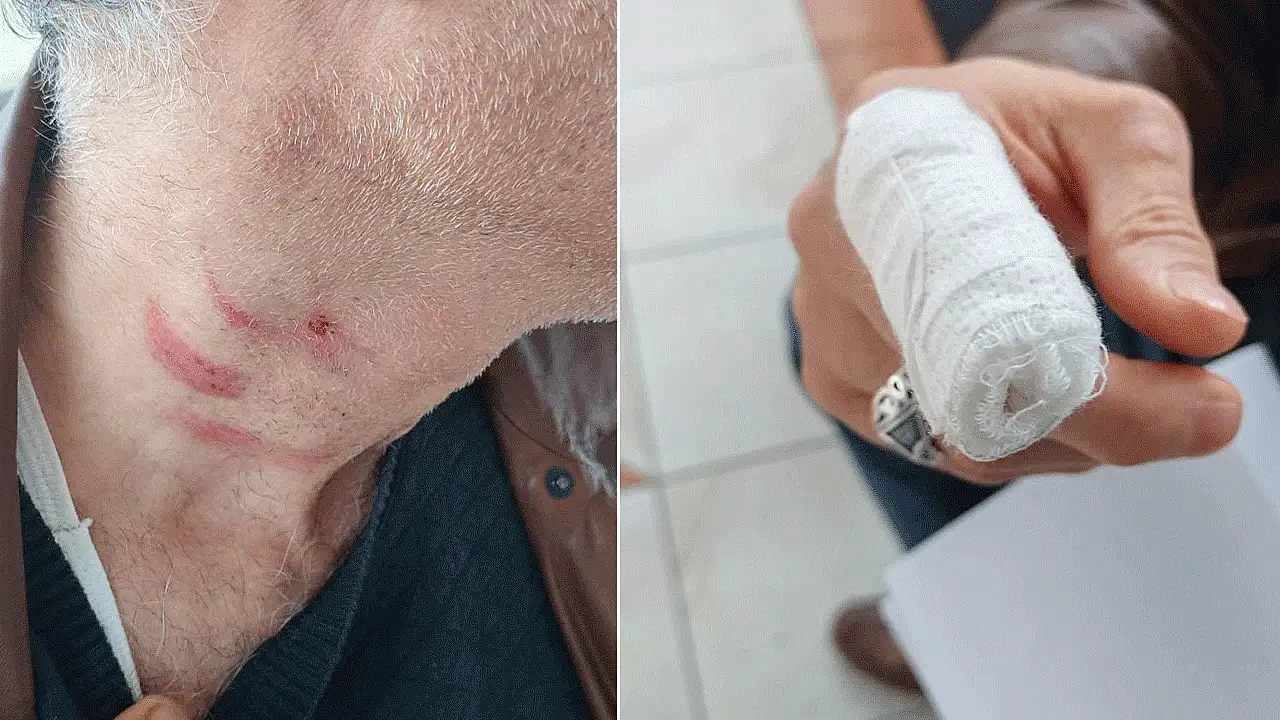 Konya'da aile hekimi ile müezzin arasında yaşanan darp olayında şok eden iddia