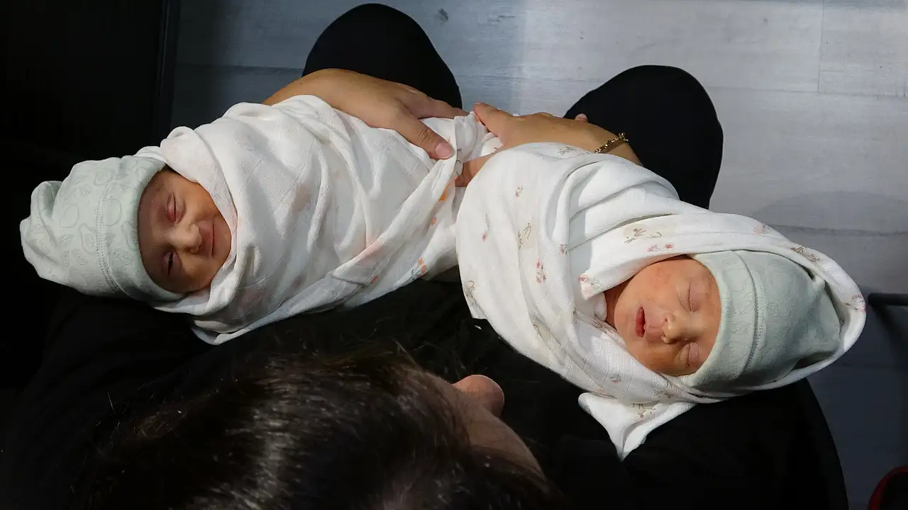 Milyonda bir görülen doğum olayı gerçekleşti