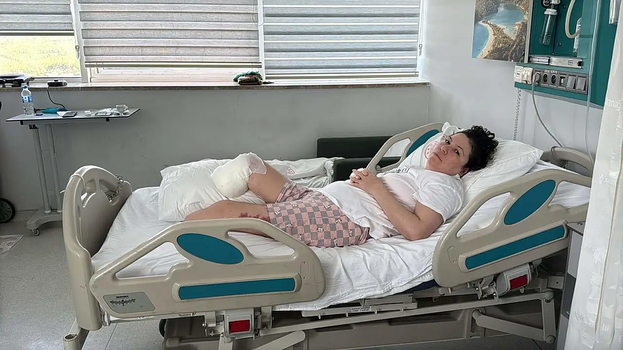 Kadına şiddetin en acı tablosu: Önce sol, sonra sağ bacağını kaybetti!