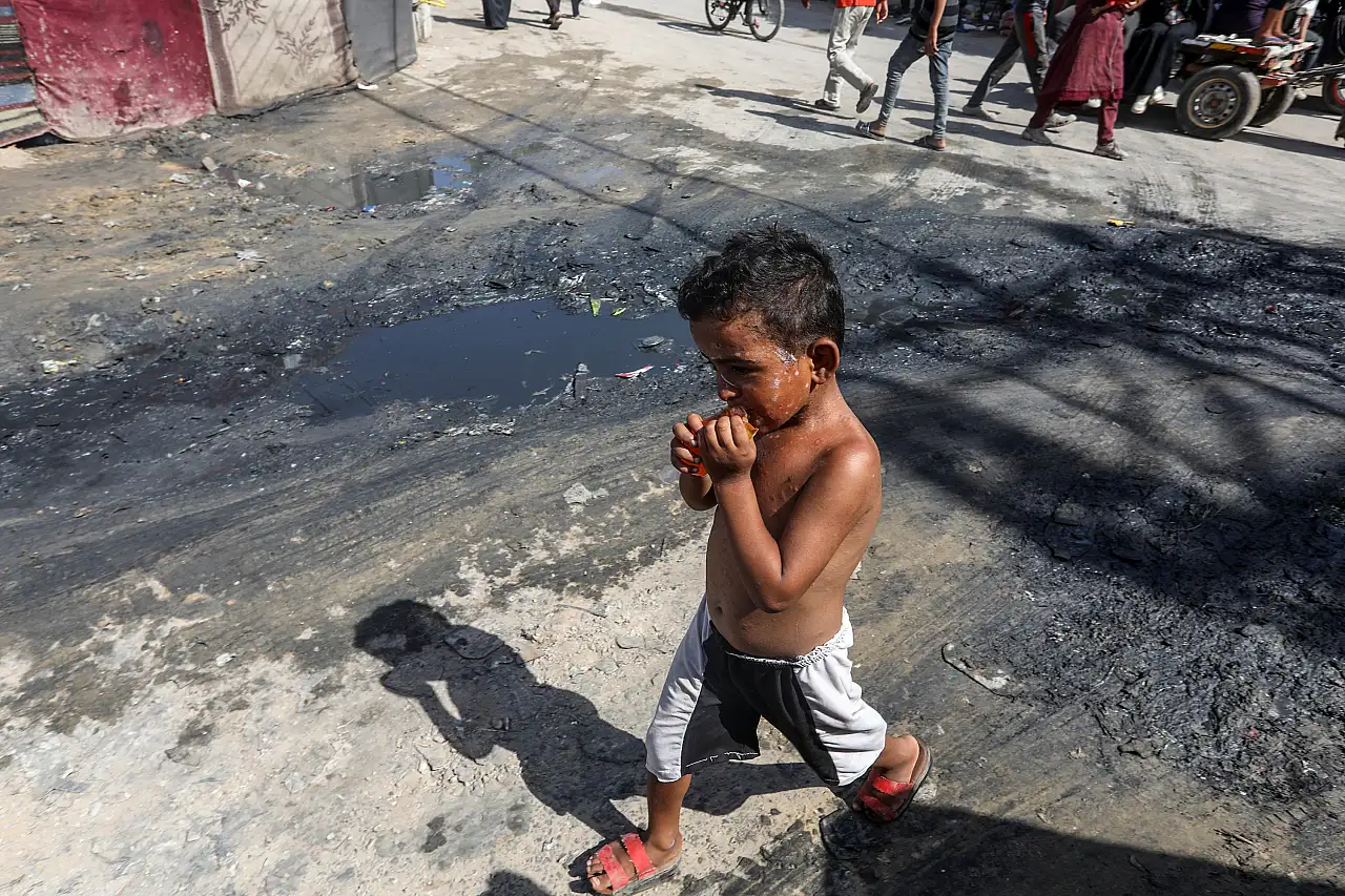Gazze' de cilt hastalıkları yaygınlaşıyor