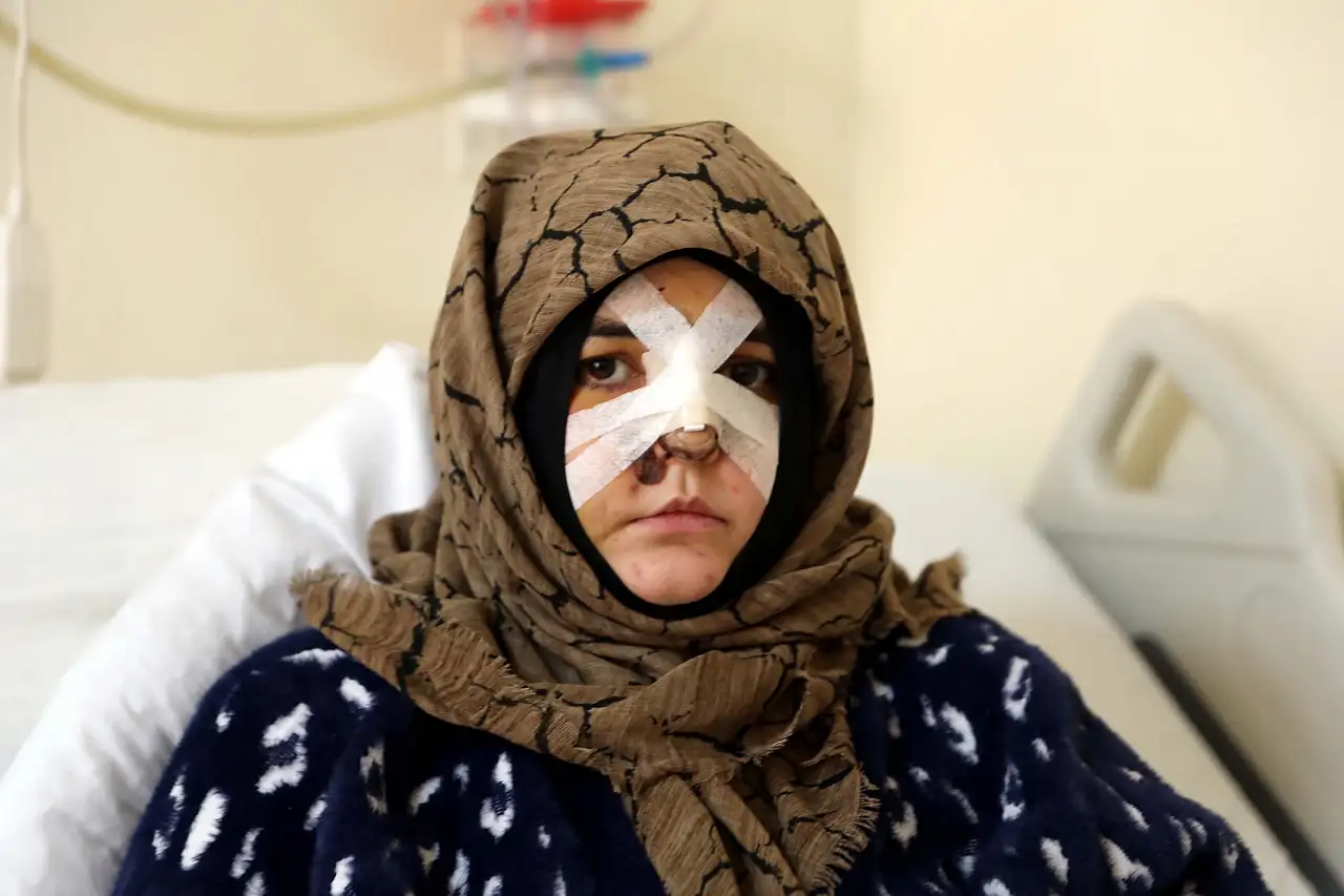 Düzeldim dedi, dehşeti yaşattı: Kaldırım taşıyla yüzü dağılan Nazlı yardım istedi