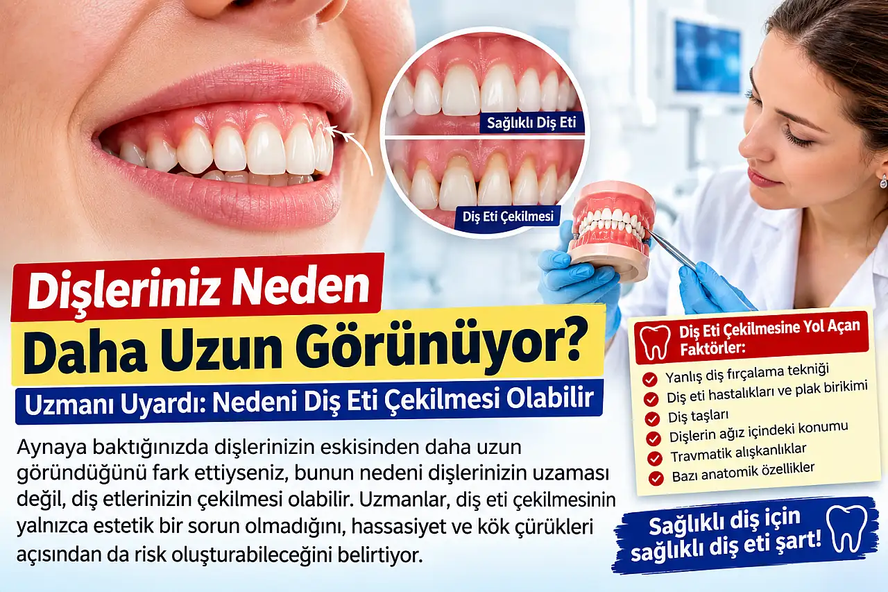 Dişleriniz neden daha uzun görünüyor? Uzmanı uyardı: Nedeni diş eti çekilmesi olabilir