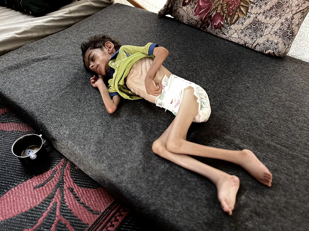 6 yaşındaki bir çocuk daha ölüm tehlikesiyle karşı karşıya