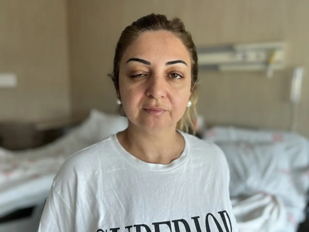 Botoks hayali faciayla bitti!