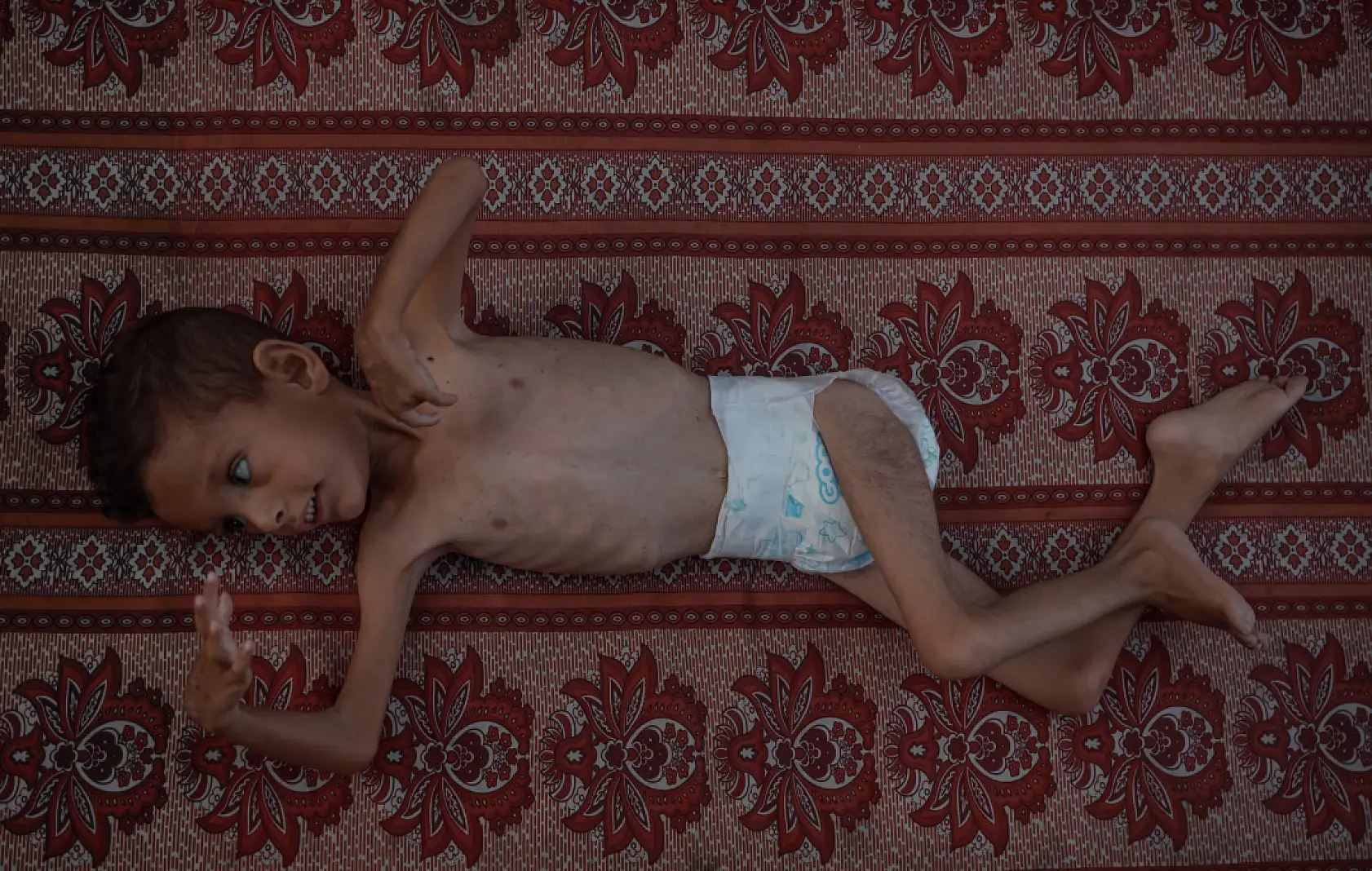 21. Yüzyılın utancı: Uzay çağında açlıktan ölen çocuklar!