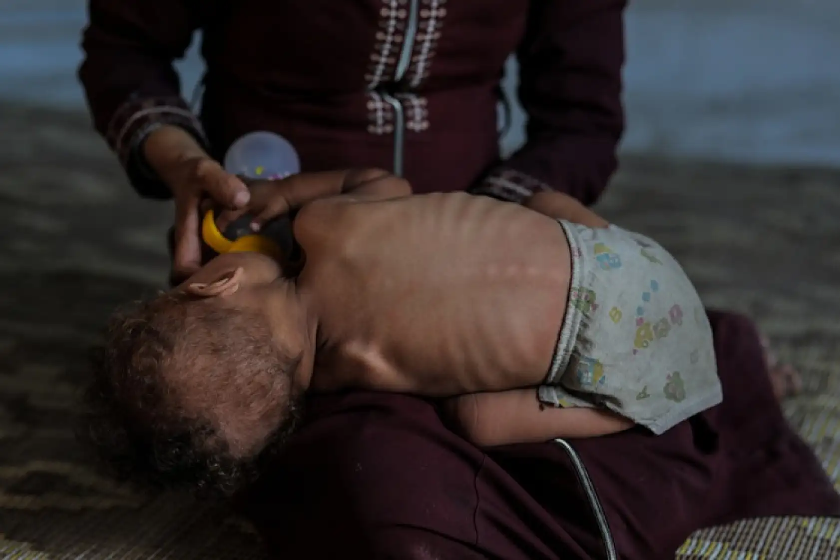 Açlıktan hayatını kaybedenlerin sayısı 263'e yükseldi