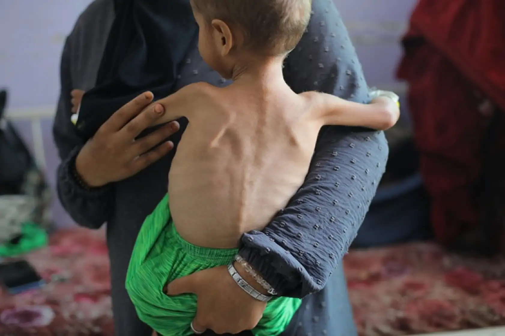 Açlıktan hayatını kaybedenlerin sayısı 263'e yükseldi