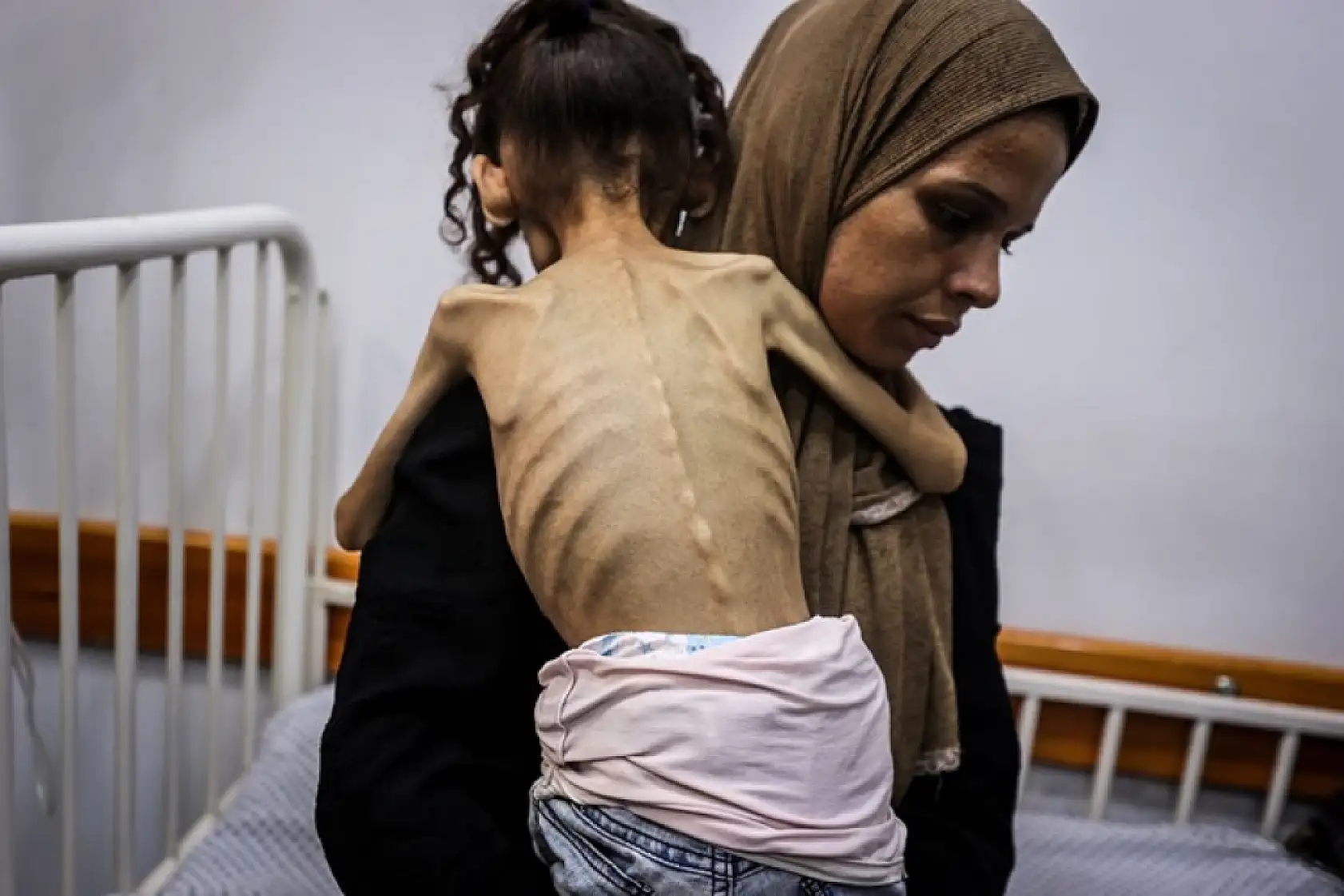 Açlıktan hayatını kaybedenlerin sayısı 263'e yükseldi