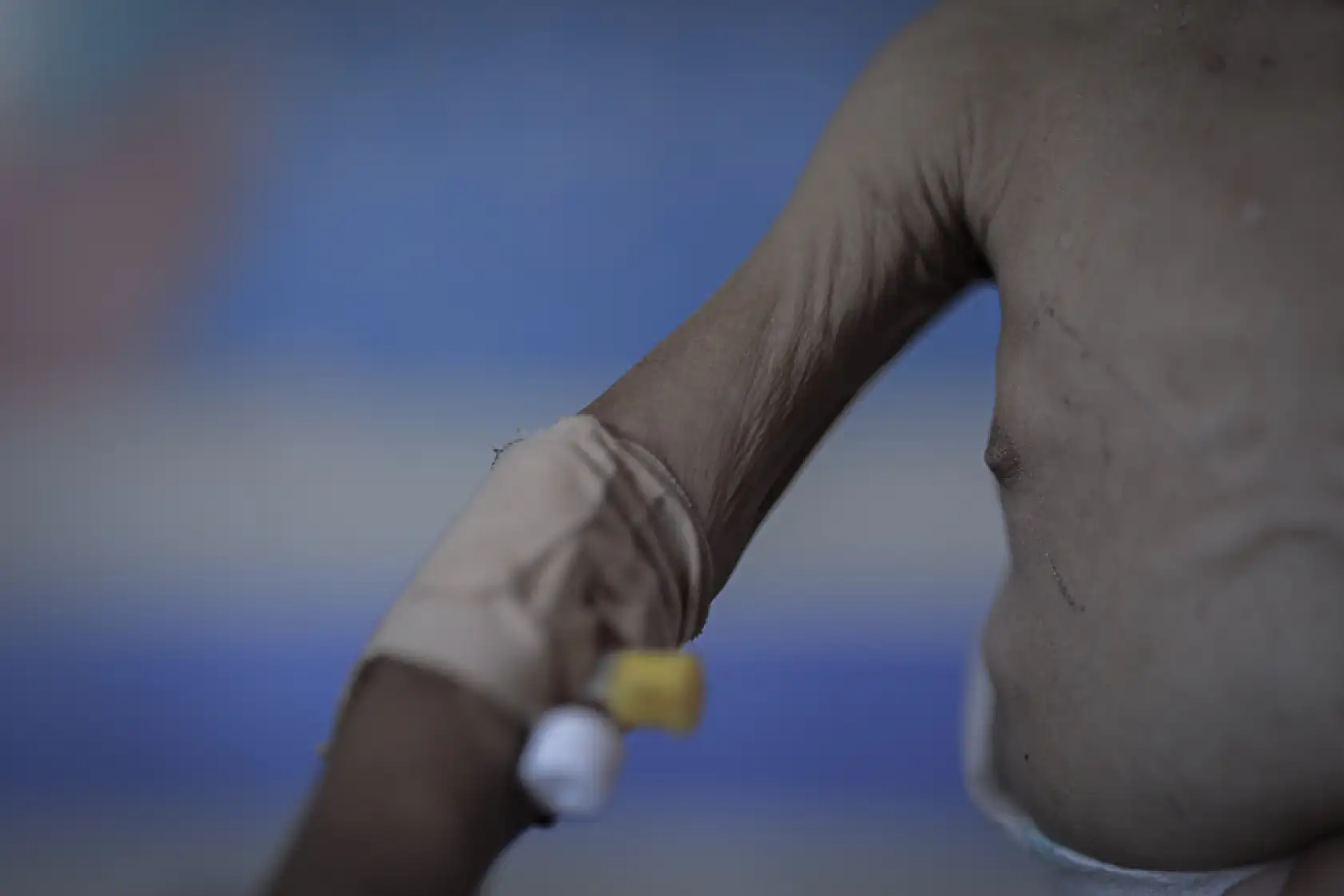 7 aylık bebek ölümün eşiğinde!