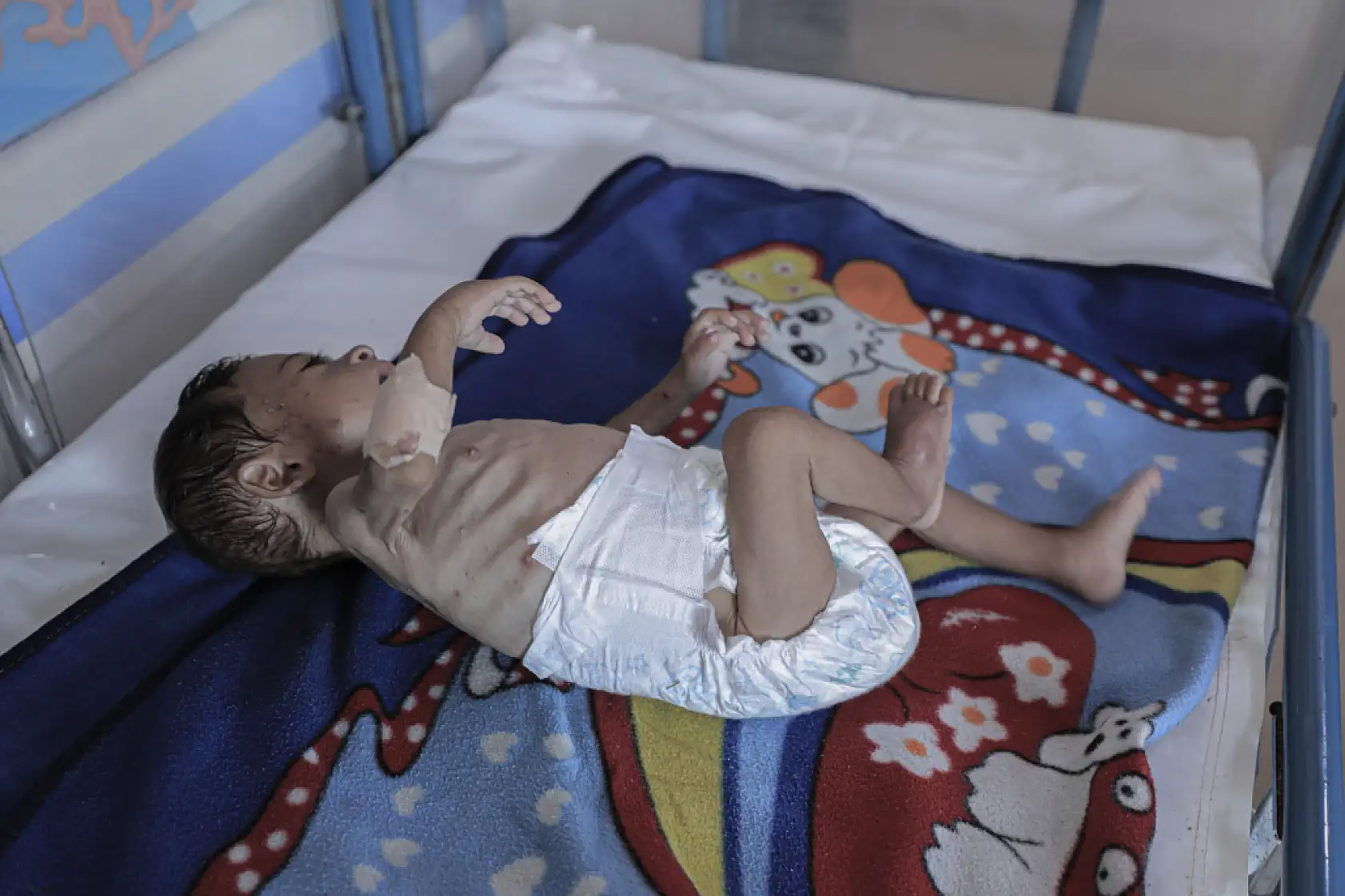 7 aylık bebek ölümün eşiğinde!