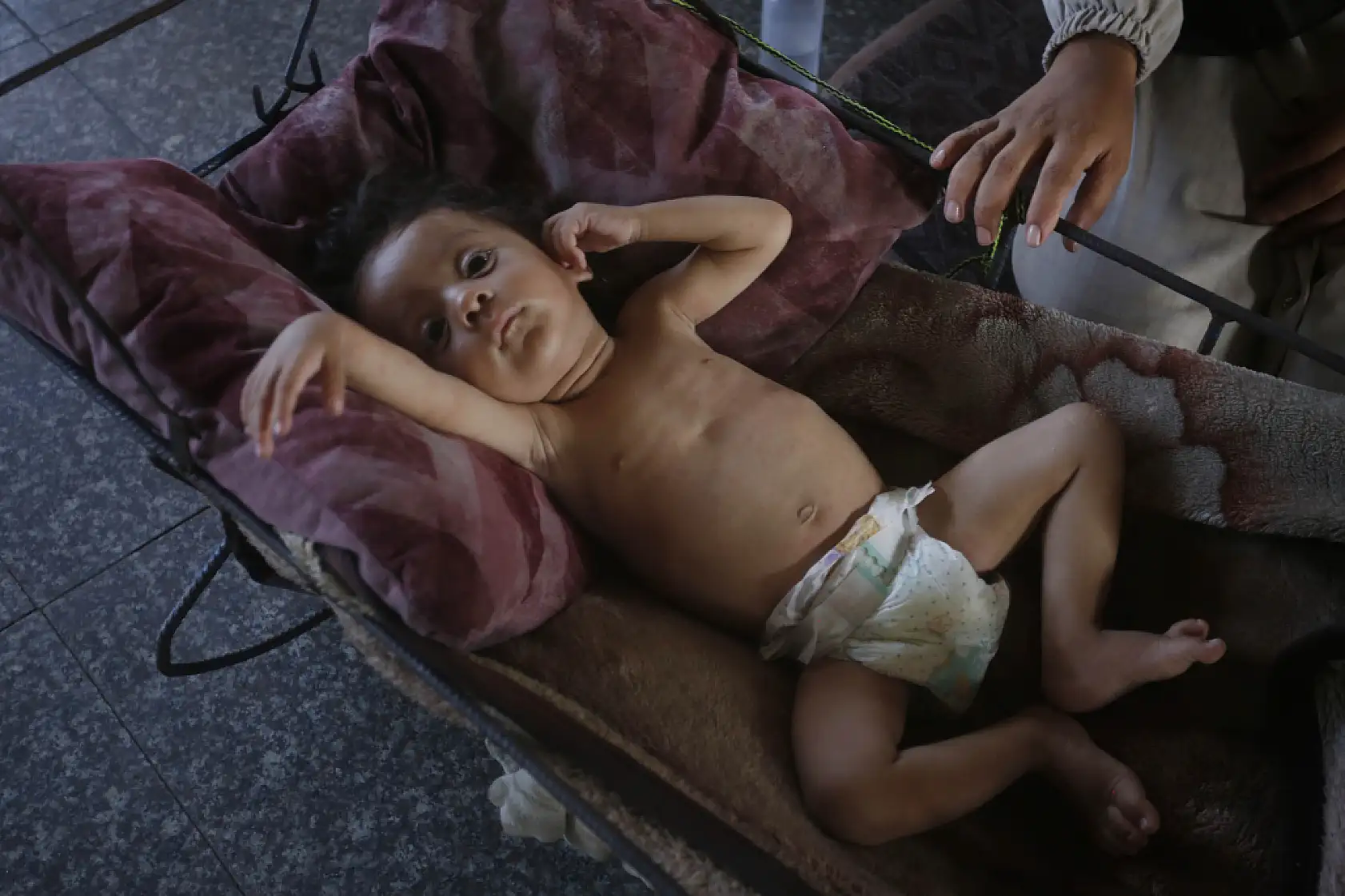 Bebekler açlıkla mücadele ediyor