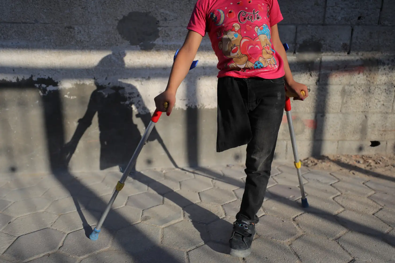 9 yaşındaki kız çocuğu protez bacak sahibi olmayı bekliyor