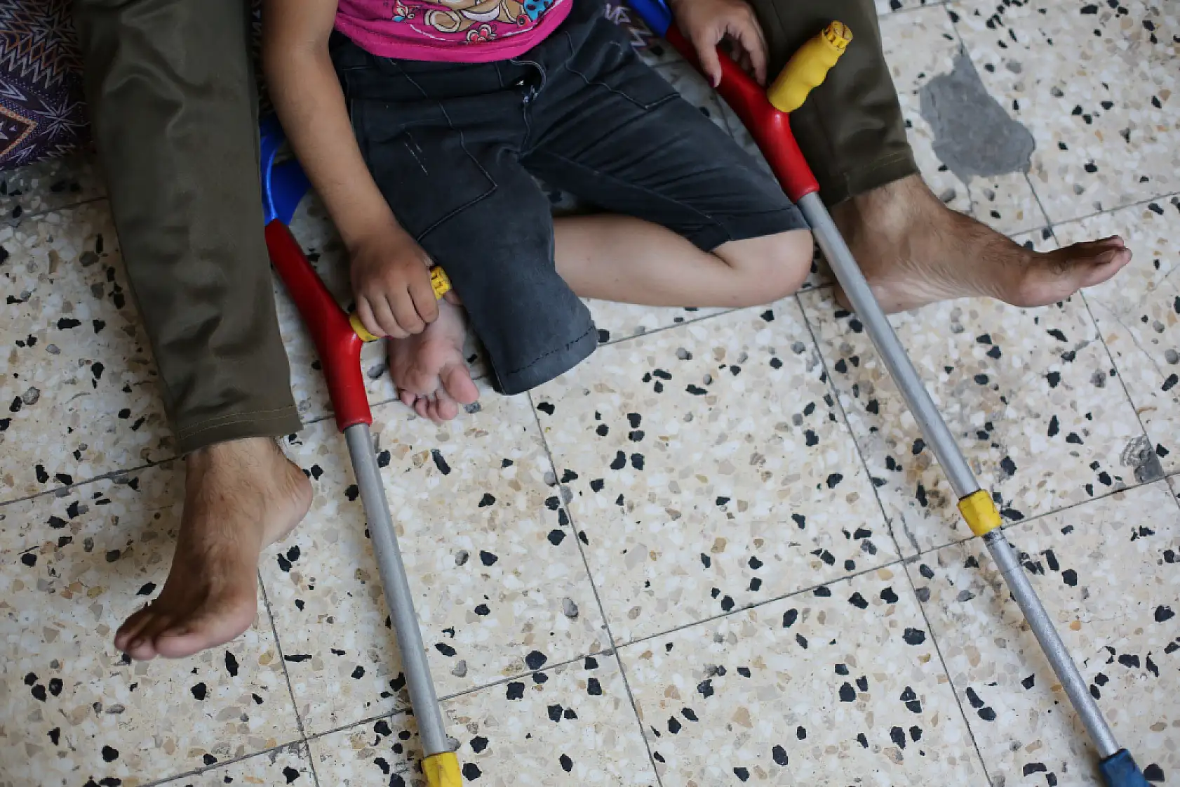 9 yaşındaki kız çocuğu protez bacak sahibi olmayı bekliyor