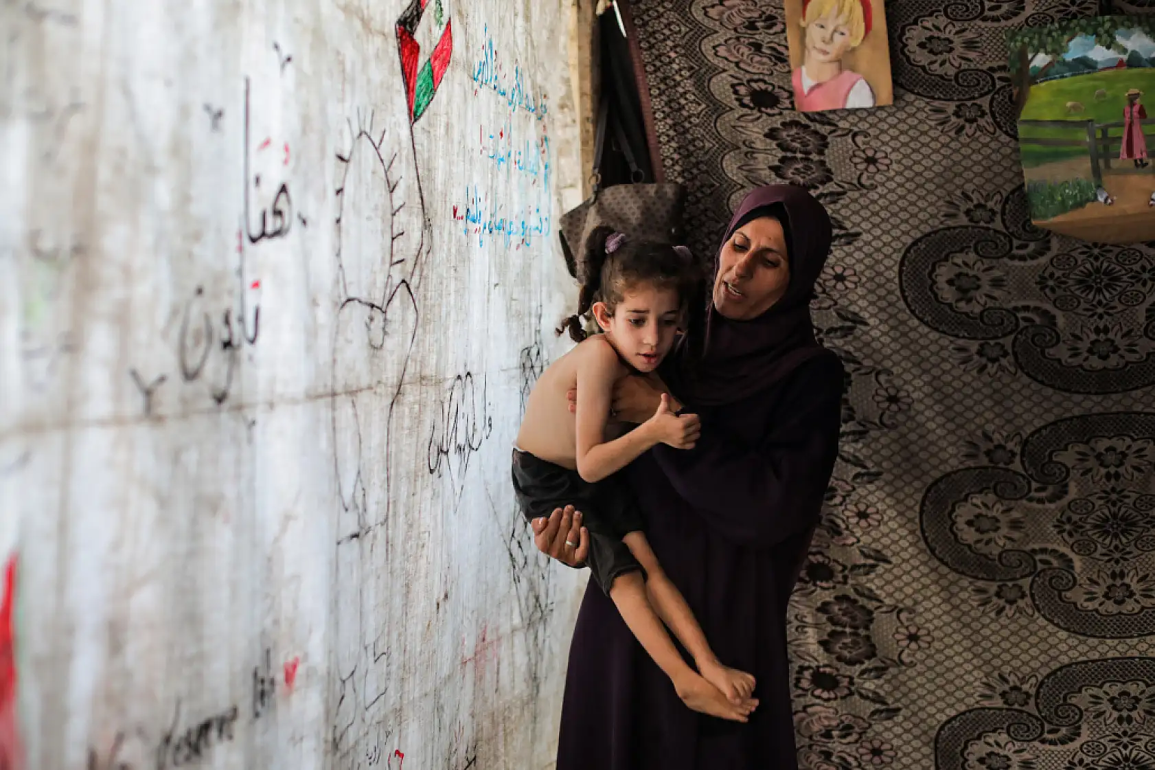 5 yaşındaki Dalya, oksijen eksikliği ve yetersiz beslenme sorunuyla mücadele ediyor