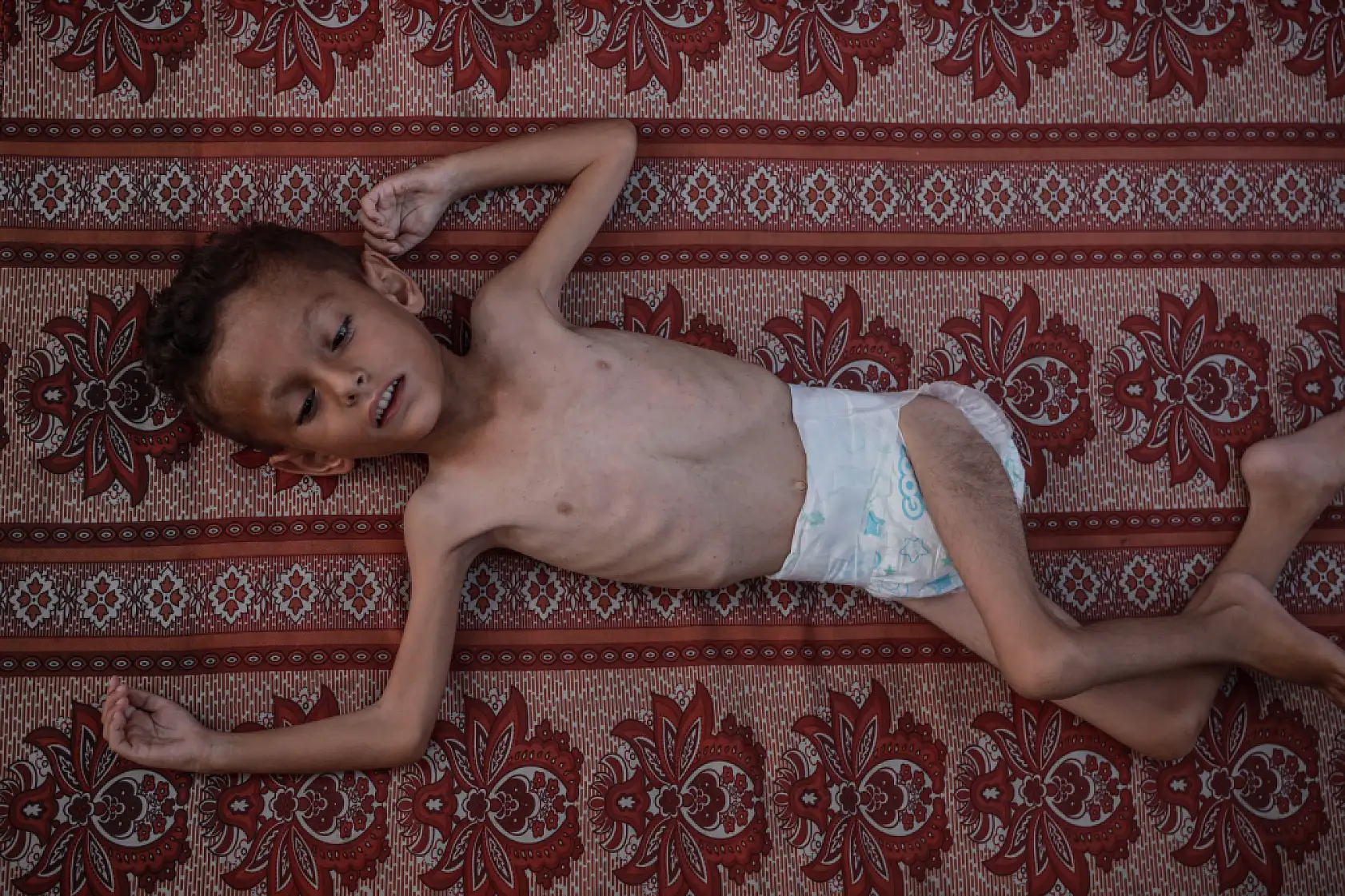 21. Yüzyılın utancı: Uzay çağında açlıktan ölen çocuklar!