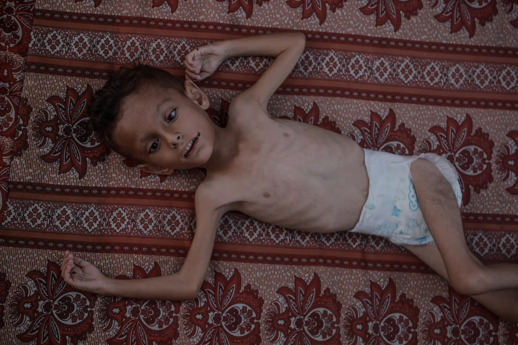 21. Yüzyılın utancı: Uzay çağında açlıktan ölen çocuklar!