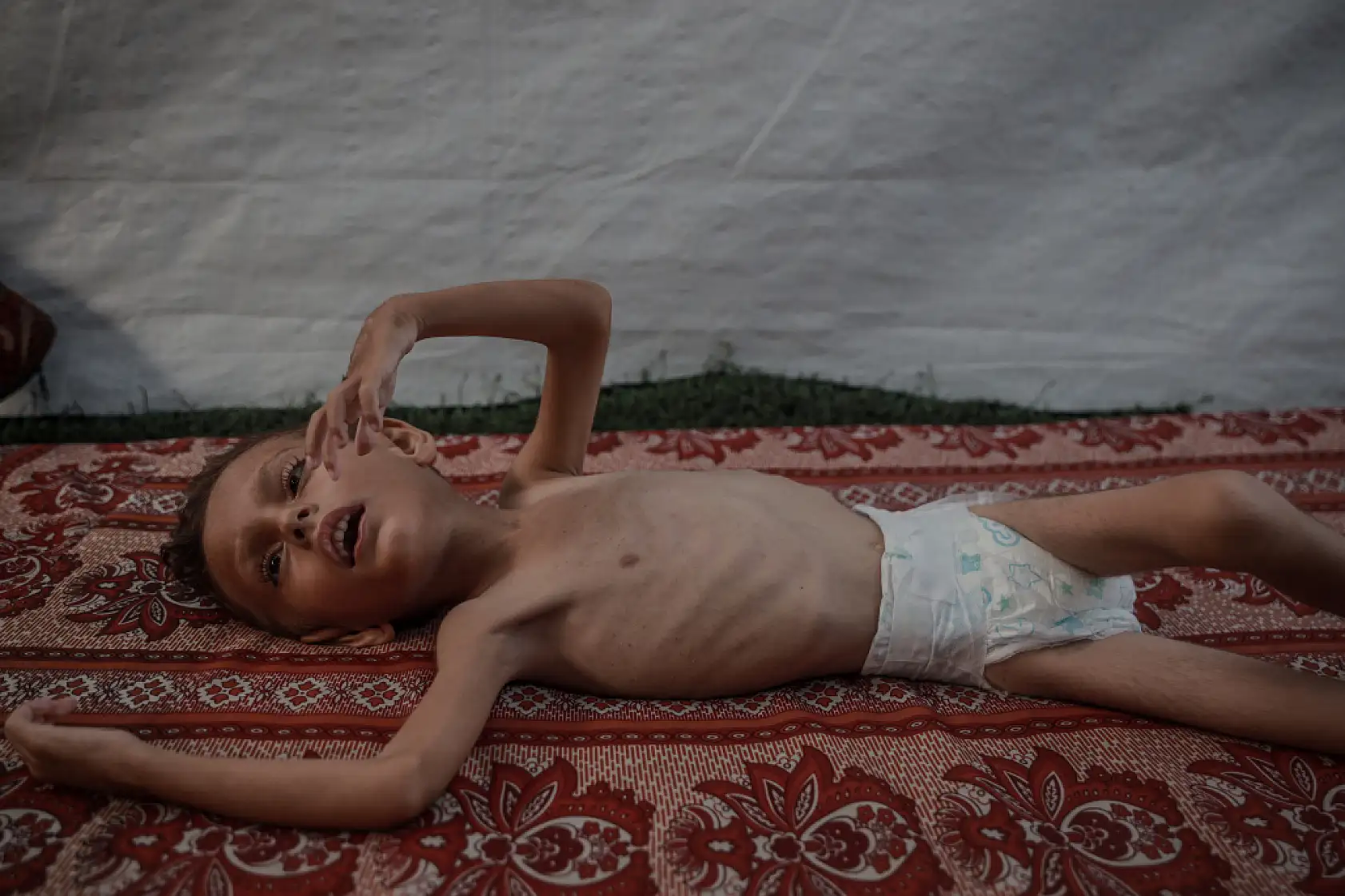 21. Yüzyılın utancı: Uzay çağında açlıktan ölen çocuklar!