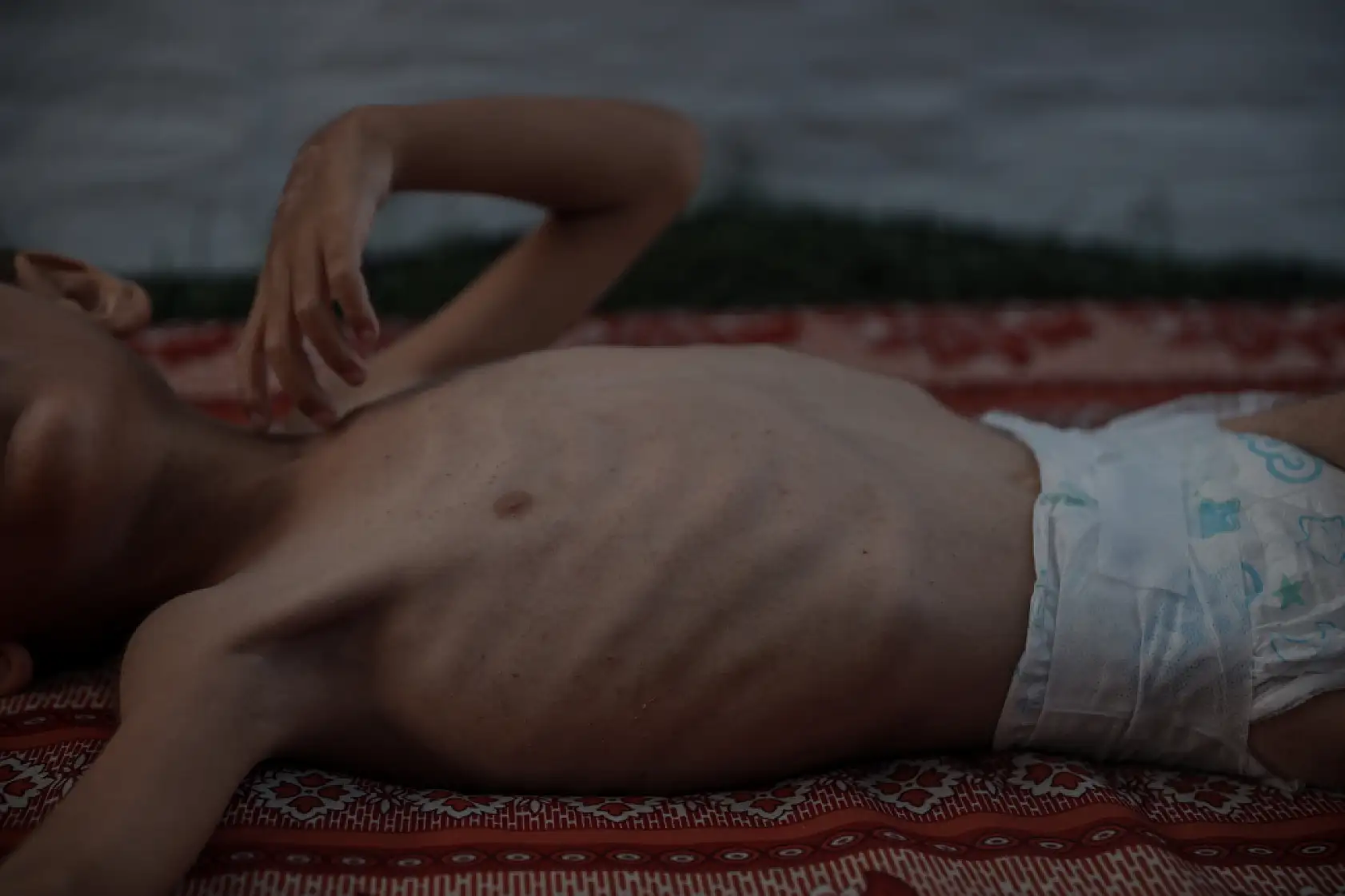 21. Yüzyılın utancı: Uzay çağında açlıktan ölen çocuklar!